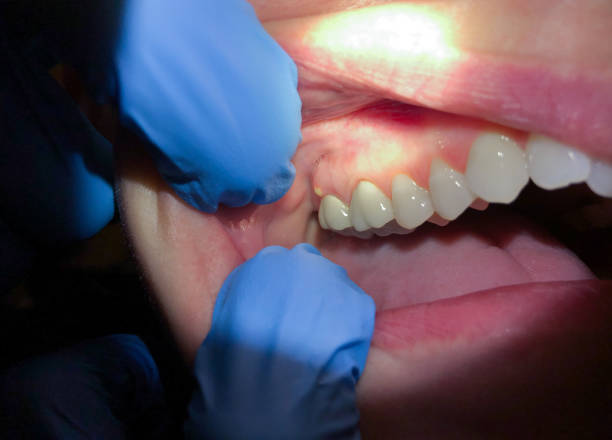 Best Weekend Emergency Dentist in Combine, TX